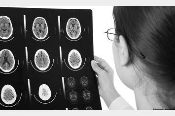 Doctor examining brain scan
