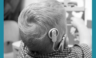 Cochlear Implants